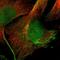 Inositol Hexakisphosphate Kinase 2 antibody, NBP1-89635, Novus Biologicals, Immunofluorescence image 