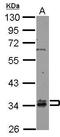 Rab Geranylgeranyltransferase Subunit Beta antibody, GTX105874, GeneTex, Western Blot image 