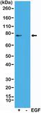 Ribosomal Protein S6 Kinase A1 antibody, MA5-24701, Invitrogen Antibodies, Western Blot image 