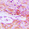 Insulin Receptor antibody, LS-C368392, Lifespan Biosciences, Immunohistochemistry paraffin image 