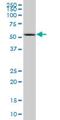 Cytochrome P450 Family 2 Subfamily D Member 6 antibody, H00001565-M07, Novus Biologicals, Western Blot image 