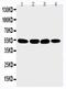 Matrilin 3 antibody, PA1927, Boster Biological Technology, Western Blot image 