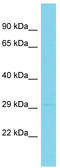 Interleukin 20 Receptor Subunit Beta antibody, TA343042, Origene, Western Blot image 