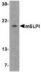 Secretory Leukocyte Peptidase Inhibitor antibody, TA306440, Origene, Western Blot image 