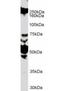 Roundabout Guidance Receptor 1 antibody, orb19276, Biorbyt, Western Blot image 