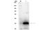 Carbonic Anhydrase 1 antibody, A00170, Boster Biological Technology, Western Blot image 