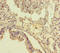 Transmembrane Protein 64 antibody, LS-C679836, Lifespan Biosciences, Immunohistochemistry paraffin image 