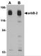 ERBB2 antibody, 5153, ProSci, Western Blot image 