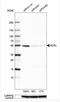 Adenylosuccinate Lyase antibody, NBP1-87406, Novus Biologicals, Western Blot image 