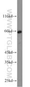 CD58 Molecule antibody, 10878-1-AP, Proteintech Group, Western Blot image 