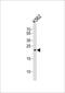 Mitochondrially Encoded NADH:Ubiquinone Oxidoreductase Core Subunit 3 antibody, PA5-48356, Invitrogen Antibodies, Western Blot image 