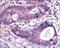 Polo Like Kinase 1 antibody, P00182, Boster Biological Technology, Immunohistochemistry paraffin image 