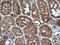 Mitogen-Activated Protein Kinase Kinase 1 antibody, LS-C174639, Lifespan Biosciences, Immunohistochemistry paraffin image 