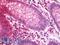 YARS antibody, LS-C210972, Lifespan Biosciences, Immunohistochemistry paraffin image 