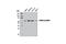 Coactivator Associated Arginine Methyltransferase 1 antibody, 12495S, Cell Signaling Technology, Western Blot image 