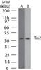 Receptor Like Tyrosine Kinase antibody, MA1-41038, Invitrogen Antibodies, Western Blot image 