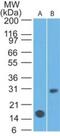 Interleukin 7 Receptor antibody, NBP2-22376, Novus Biologicals, Western Blot image 