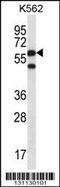 Chaperonin Containing TCP1 Subunit 8 antibody, MBS9201552, MyBioSource, Western Blot image 