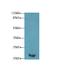 Fetal and adult testis-expressed transcript protein antibody, A66582-100, Epigentek, Western Blot image 