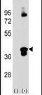 C1q And TNF Related 1 antibody, PA5-13558, Invitrogen Antibodies, Western Blot image 