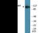 ATPase Na+/K+ Transporting Subunit Alpha 1 antibody, EKC2054, Boster Biological Technology, Western Blot image 