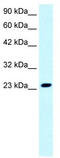 MYST/Esa1 Associated Factor 6 antibody, TA333700, Origene, Western Blot image 
