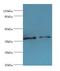 Cathepsin V antibody, LS-B16874, Lifespan Biosciences, Western Blot image 