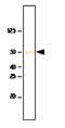 SET Domain Containing 7, Histone Lysine Methyltransferase antibody, MBS830066, MyBioSource, Western Blot image 