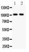 GluA1 antibody, LS-C344056, Lifespan Biosciences, Western Blot image 