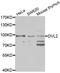 Dishevelled Segment Polarity Protein 2 antibody, LS-C349235, Lifespan Biosciences, Western Blot image 