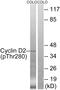 Cyclin D2 antibody, PA5-39783, Invitrogen Antibodies, Western Blot image 