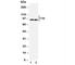 Protein Tyrosine Kinase 2 antibody, R30650, NSJ Bioreagents, Western Blot image 