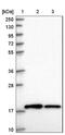 Ribosomal Protein S10 antibody, NBP2-48870, Novus Biologicals, Western Blot image 