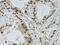 Deoxycytidine Kinase antibody, 18-165, ProSci, Immunohistochemistry frozen image 