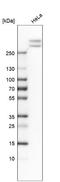 Spectrin Alpha, Non-Erythrocytic 1 antibody, NBP1-89460, Novus Biologicals, Western Blot image 