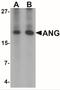 Angiogenin antibody, NBP2-41185, Novus Biologicals, Western Blot image 