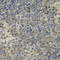 Ferritin Light Chain antibody, A1768, ABclonal Technology, Immunohistochemistry paraffin image 