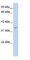 TNMD antibody, ab81328, Abcam, Western Blot image 