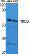 Ammonium transporter Rh type C antibody, STJ96453, St John