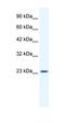 Potassium Channel Tetramerization Domain Containing 11 antibody, orb329839, Biorbyt, Western Blot image 