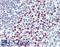 Peptidyl Arginine Deiminase 4 antibody, LS-C331758, Lifespan Biosciences, Immunohistochemistry paraffin image 