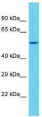 Sterile Alpha Motif Domain Containing 1 antibody, TA331667, Origene, Western Blot image 