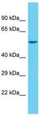 Sterile Alpha Motif Domain Containing 1 antibody, TA331667, Origene, Western Blot image 