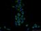 KH Domain Containing 1 antibody, 23443-1-AP, Proteintech Group, Immunofluorescence image 