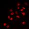 ERBB2 antibody, orb10372, Biorbyt, Immunofluorescence image 