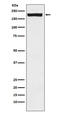 Mannose Receptor C Type 2 antibody, M04070-1, Boster Biological Technology, Western Blot image 