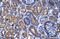 Proteasome 26S Subunit, Non-ATPase 11 antibody, ARP33002_T100, Aviva Systems Biology, Immunohistochemistry paraffin image 