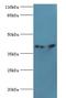 Ciliary Neurotrophic Factor Receptor antibody, LS-C369427, Lifespan Biosciences, Western Blot image 