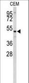 Carnosine Dipeptidase 1 antibody, LS-C168872, Lifespan Biosciences, Western Blot image 