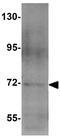 Anoctamin 1 antibody, GTX85012, GeneTex, Western Blot image 